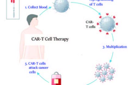 CAR-T cell therapy: CAR T-cell therapy uses genetically engineered T cells to intensify the immune systems response to cancer. T-cells with chimeric antigen receptor recognize and kill the cancer cells in the body. 216