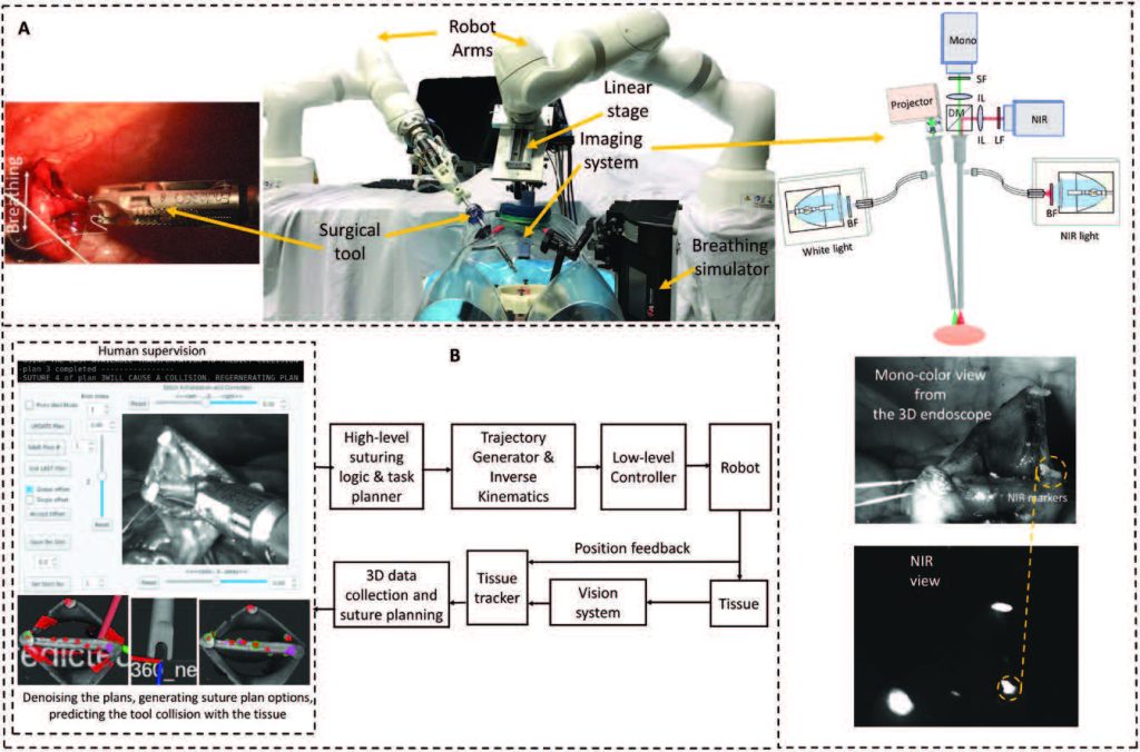 Enhanced autonomous laparoscopic soft tissue surgery.
(A) The components of the STAR system, including medical robotic arms, actuated surgical tools, and dual-channel NIR and 3D structured light endoscopic imaging system. (B) Control architecture of the enhanced autonomous control strategy for STAR.
Photo Source: Saeidi et al., Sci. Robot. 2022, 7